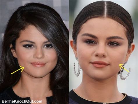 selena gomez nose|Selena Gomez Opens Up About Cosmetic Surgery & Reacts to。